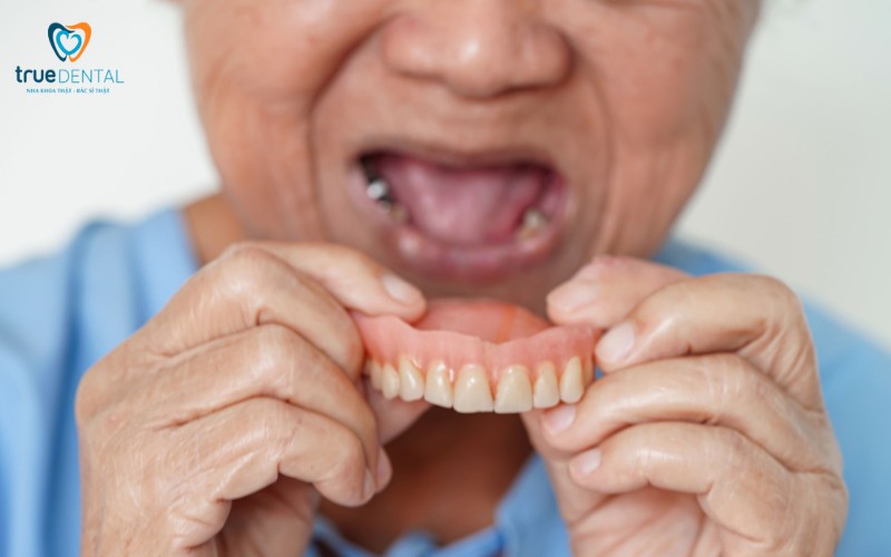 Lợi ích cấy ghép implant cho nụ cười thẩm mỹ hoàn hảo 6 Lợi ích cấy ghép implant cho nụ cười thẩm mỹ