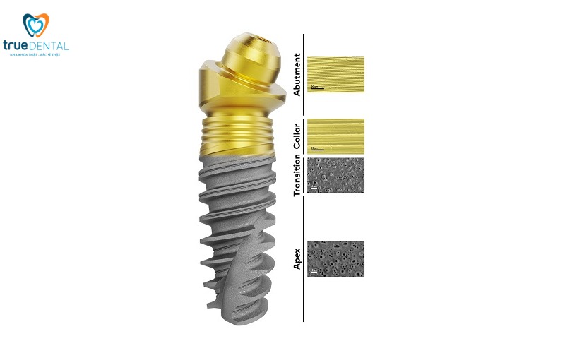 Thời gian chờ tích hợp xương sau cấy implant: Những điều cần biết! 3 thời gian chờ tích hợp xương sau cấy implant