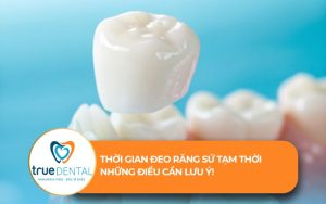 thời gian đeo răng sứ tạm thời