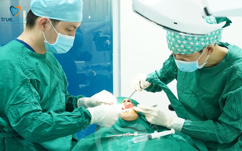 Ưu điểm trụ implant Nobel Biocare: Lựa chọn hàng đầu cho răng giả 7 ưu điểm trụ implant nobel biocare