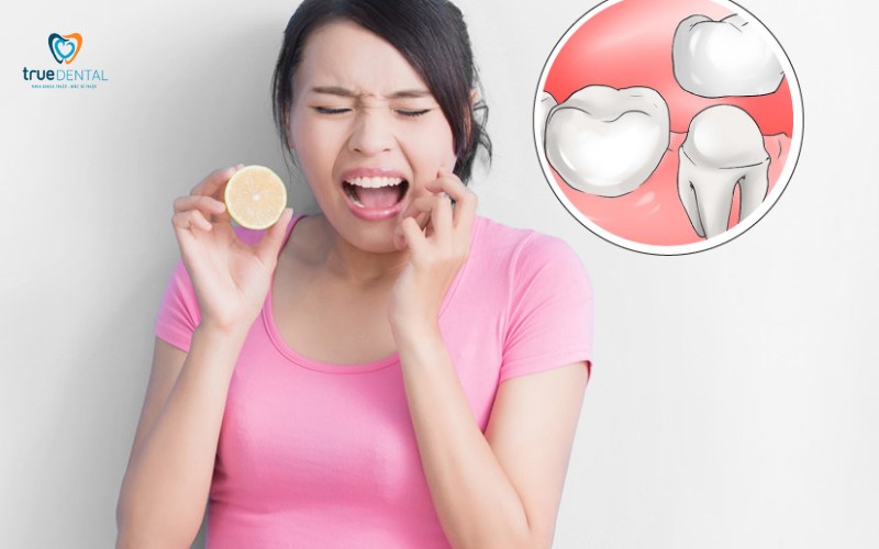 Bọc răng sứ có đau khi ăn không? Giải đáp và cách giảm ê buốt 1 Bọc răng sứ có đau khi ăn không