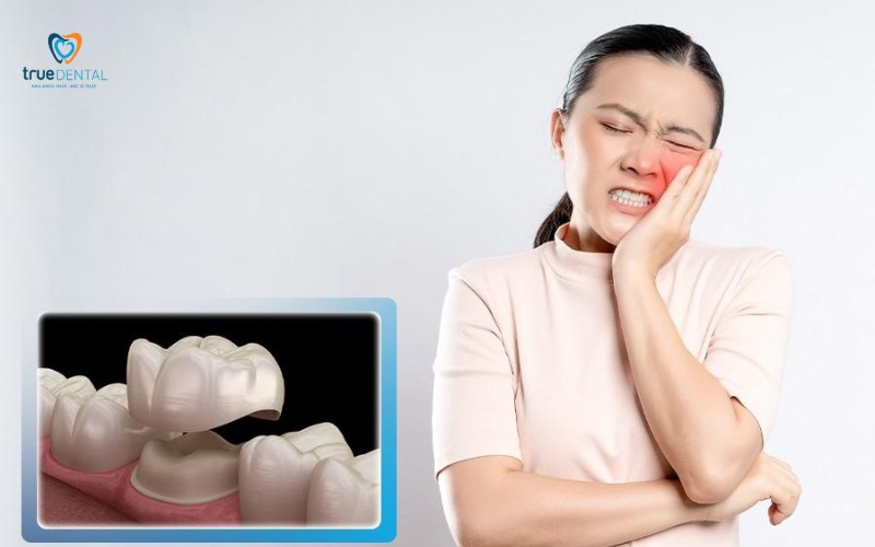 Bọc răng sứ có đau khi ăn không? Giải đáp và cách giảm ê buốt 2 Bọc răng sứ có đau khi ăn không