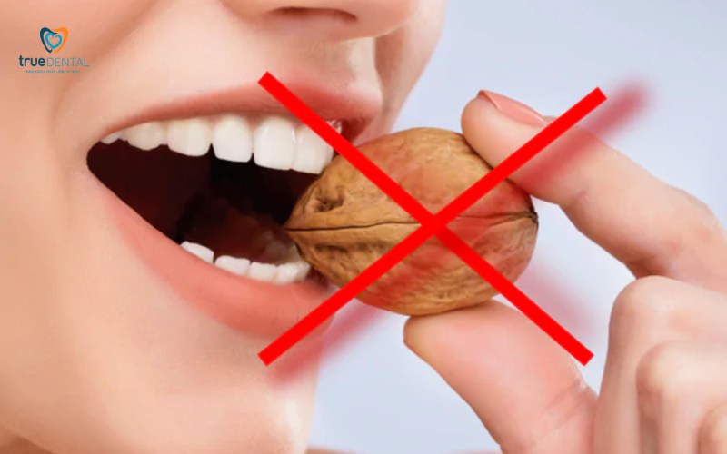 Bọc răng sứ có đau khi ăn không? Giải đáp và cách giảm ê buốt 4 Bọc răng sứ có đau khi ăn không