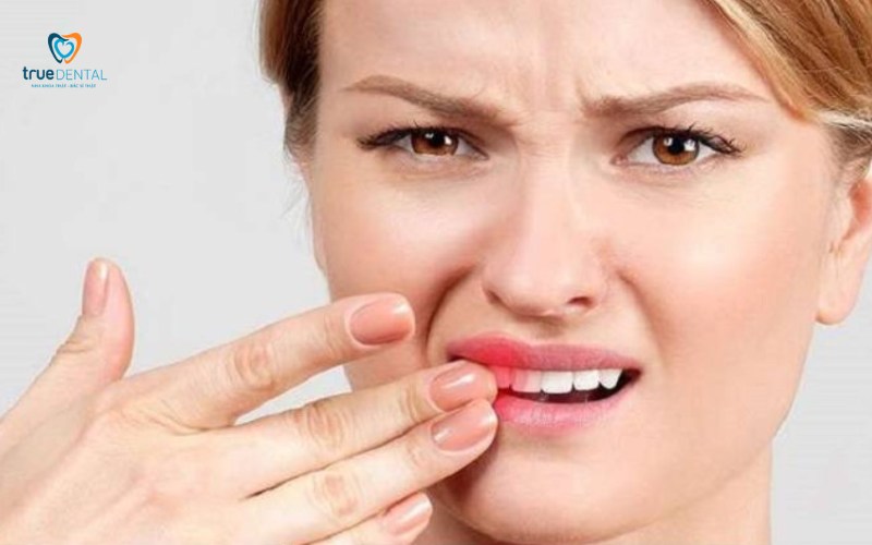 Bọc răng sứ có đau khi ăn không? Giải đáp và cách giảm ê buốt 5 Bọc răng sứ có đau khi ăn không