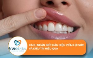 cách nhận biết dấu hiệu viêm lợi sớm