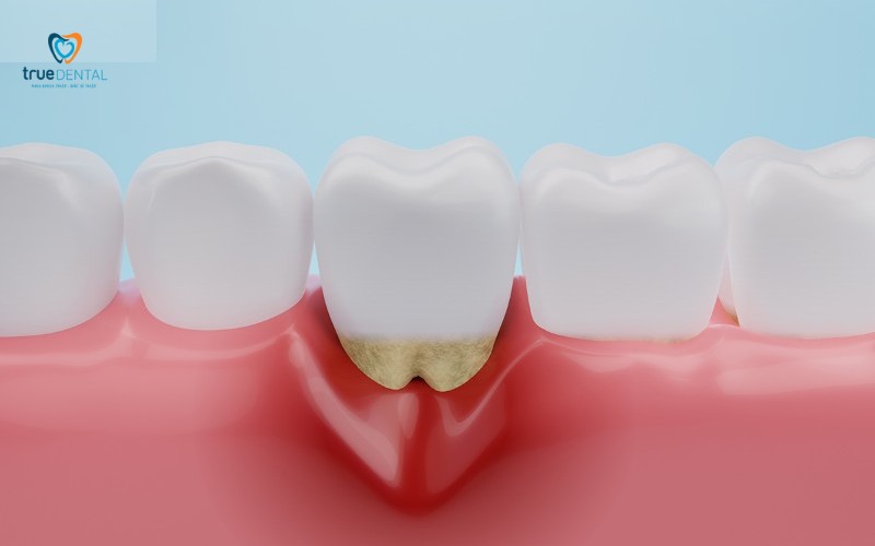 Top địa chỉ khám sức khỏe răng miệng giá rẻ tại TP.HCM 1 địa chỉ khám sức khỏe răng miệng giá rẻ tại tp.hcm