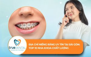địa chỉ niềng răng uy tín tại Sài Gòn