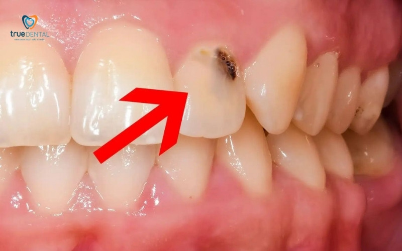 Khám răng cho người bị tiểu đường: Lưu ý quan trọng để tránh biến chứng 1 Khám răng cho người bị tiểu đường