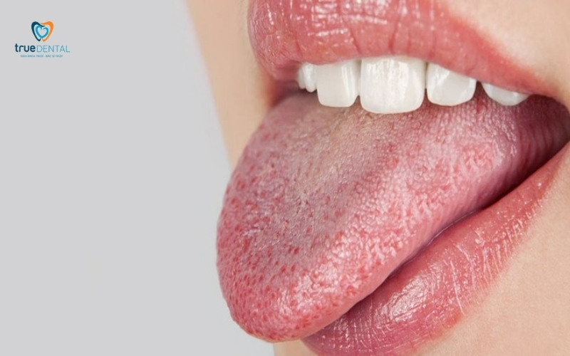 Khám răng cho người bị tiểu đường: Lưu ý quan trọng để tránh biến chứng 2 Khám răng cho người bị tiểu đường