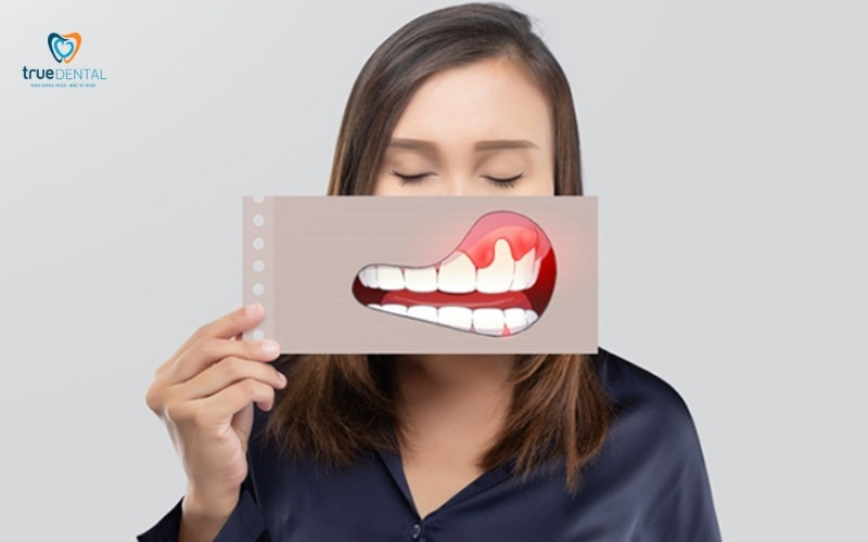 Khám răng cho người bị tiểu đường: Lưu ý quan trọng để tránh biến chứng 3 Khám răng cho người bị tiểu đường