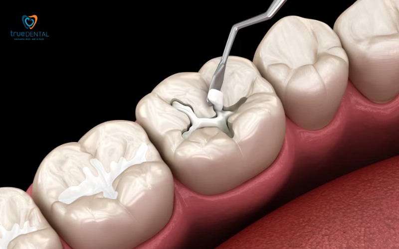 Khám răng cho người bị tiểu đường: Lưu ý quan trọng để tránh biến chứng 5 Khám răng cho người bị tiểu đường