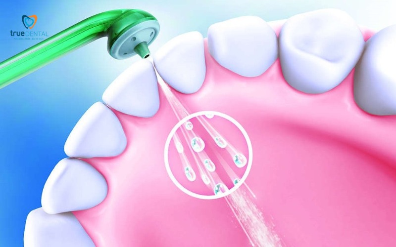 Khám răng cho người bị tiểu đường: Lưu ý quan trọng để tránh biến chứng 7 Khám răng cho người bị tiểu đường