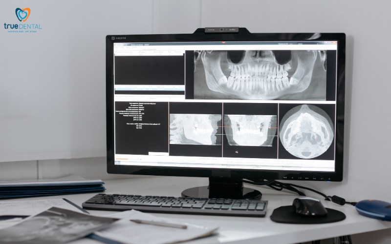 Khám răng có ảnh hưởng đến thai kỳ không? Lời khuyên từ chuyên gia 7 khám răng có ảnh hưởng đến thai kỳ không