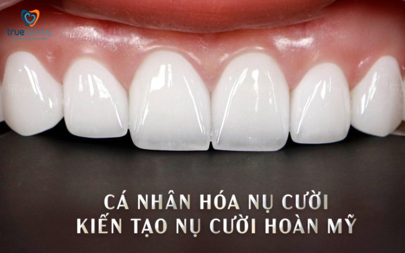 Lợi ích bọc răng sứ cho khuôn mặt: Thẩm mỹ và sức khỏe vượt trội 6 Lợi ích bọc răng sứ cho khuôn mặt
