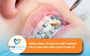 niềng răng có đau khi siết không