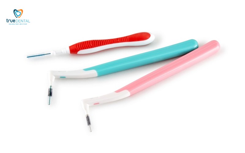 niềng răng mắc cài lingual có tốt không