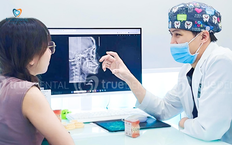 rủi ro niềng răng bị lệch sau