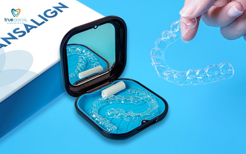so sánh niềng răng Transalign và mắc cài