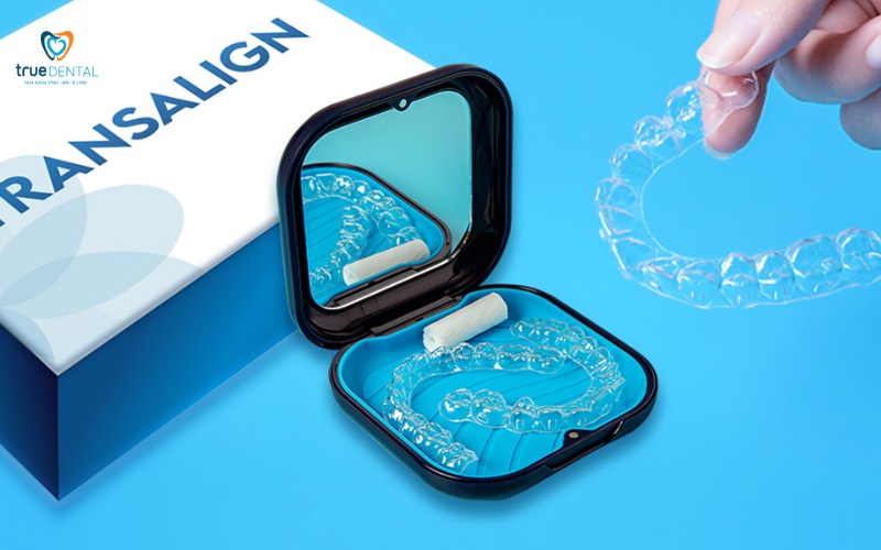 thời gian niềng răng cho răng thưa