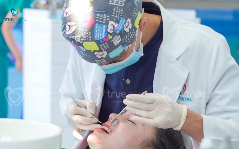 thời gian niềng răng cho răng thưa