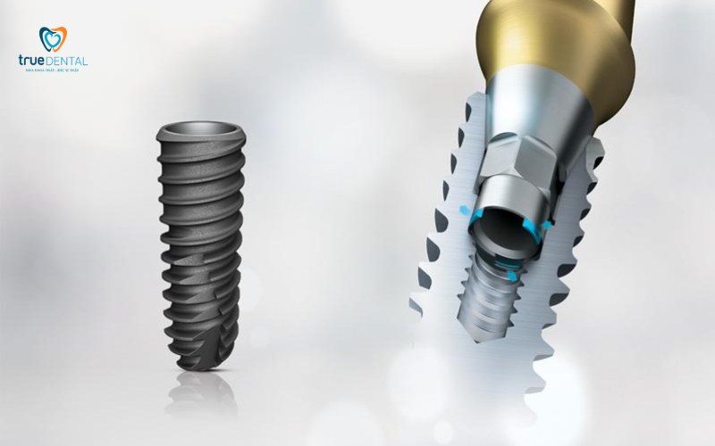 Trụ Implant Dentium Hàn Quốc có tốt không