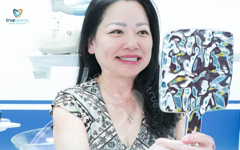 ưu điểm răng sứ nacera