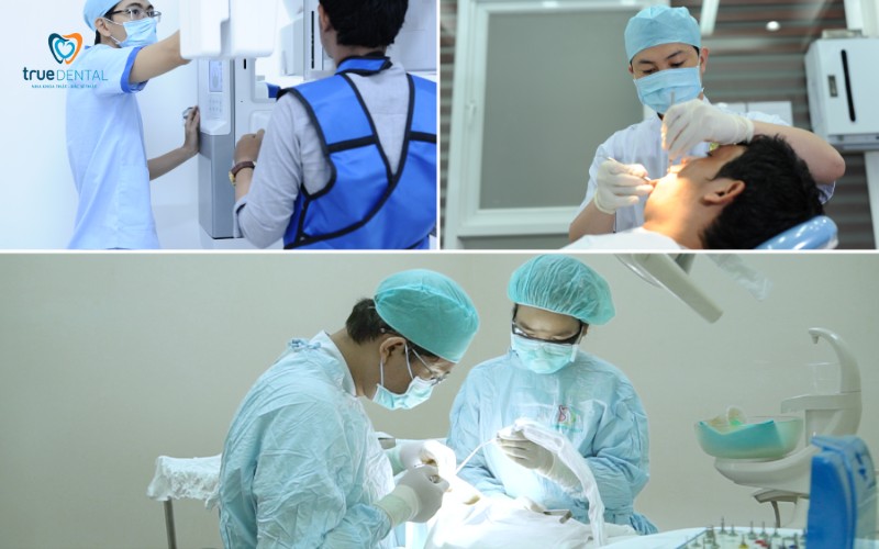 Địa chỉ cấy ghép Implant tốt nhất tại Sài Gòn