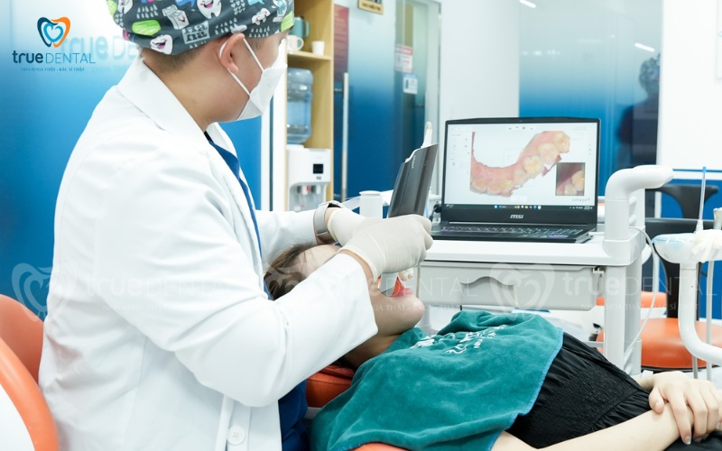 So sánh bọc răng sứ và dán veneer: Phương pháp nào phù hợp hơn? 5 So sánh bọc răng sứ và dán veneer