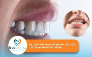 Bọc răng sứ cho người bị khớp cắn chéo
