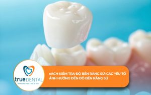 Cách kiểm tra độ bền răng sứ