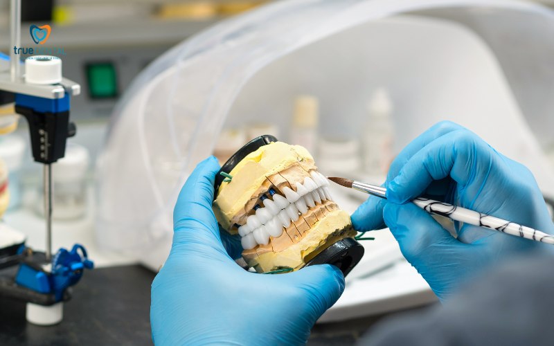 So sánh răng sứ cercon và katana: Loại nào tốt hơn? 4 Bảng giá tham khảo chi tiết dịch vụ răng sứ cercon và katana tại True Dental