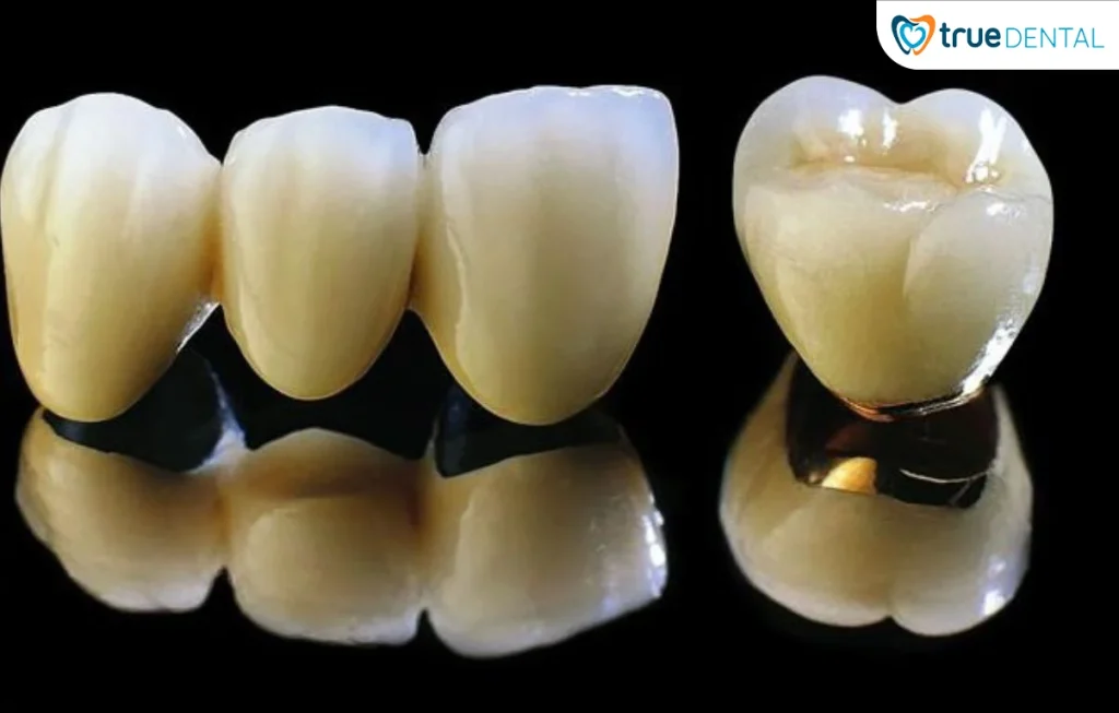 Lợi ích bọc răng sứ không mài nhiều cho sức khỏe răng 4 Lợi ích lâu dài và chính sách bảo hành vượt trội tại True Dental