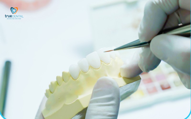 So sánh răng sứ cercon và katana: Loại nào tốt hơn? 3 Yếu tố quyết định nên chọn răng sứ cercon hay katana tại TP.HCM