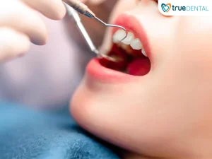 chi phí khám răng tổng quát tại TP.HCM