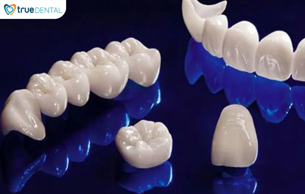 Bọc răng sứ bị vỡ khi ăn