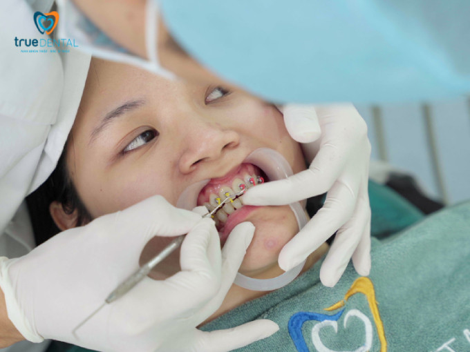 Cải thiện phát âm và giao tiếp