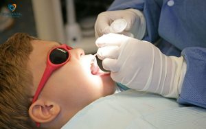 Chi phí bọc răng sứ cho trẻ em tại TP.HCM