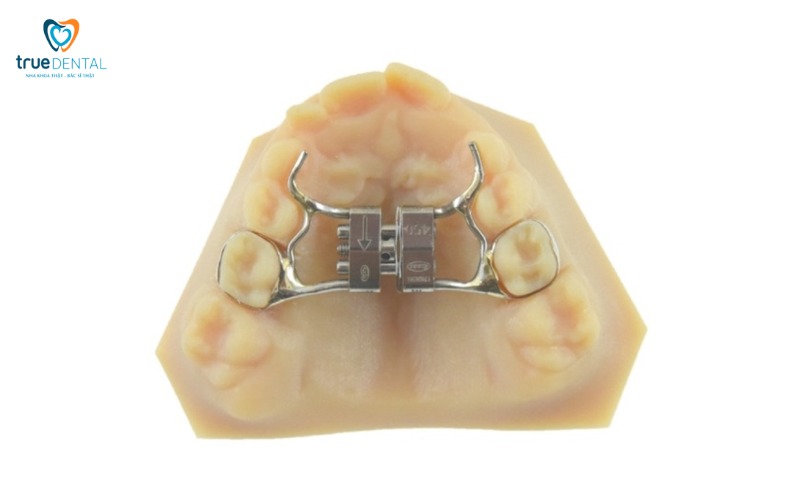 Hàm ốc nong expander là gì