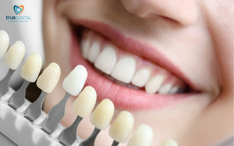 Quy trình tẩy trắng răng tại nhà đúng chuẩn tại Nha khoa True Dental