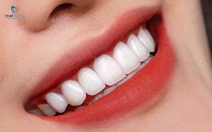 Rủi ro bọc răng sứ ở người tiểu đường