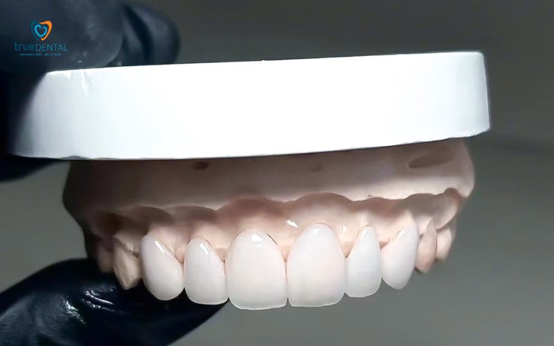 Bọc sứ bảo vệ sức khỏe răng miệng tổng thể như thế nào