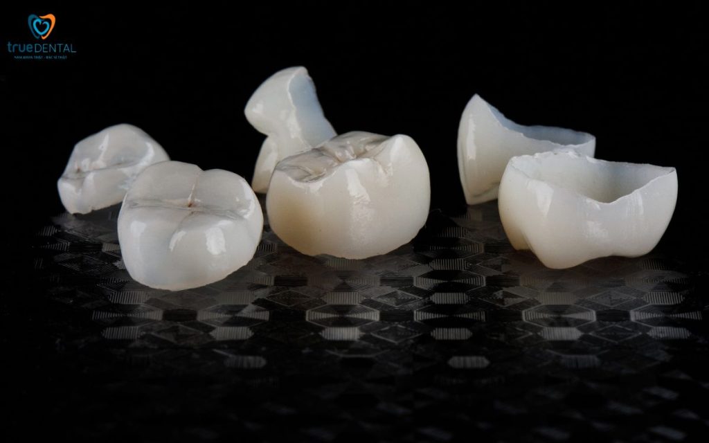 Rủi ro dị ứng với răng sứ – Nguyên nhân, dấu hiệu và cách xử lý an toàn tại Nha khoa True Dental 13 Dị ứng răng sứ là gì