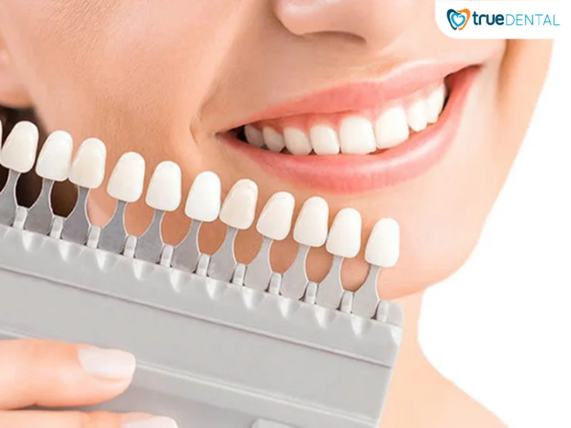 Cách chọn loại răng sứ phù hợp – Hướng dẫn từ A đến Z tại Nha khoa True Dental 12 Răng sứ nào tốt nhất cho từng nhóm đối tượng cụ thể
