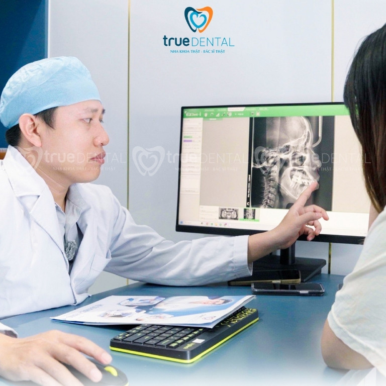 Răng vẩu là gì và nguyên nhân hình thành