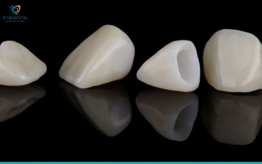 Rủi ro dị ứng với răng sứ – Nguyên nhân, dấu hiệu và cách xử lý an toàn tại Nha khoa True Dental 16 Xử lý khi đã gặp biến chứng dị ứng sau bọc sứ