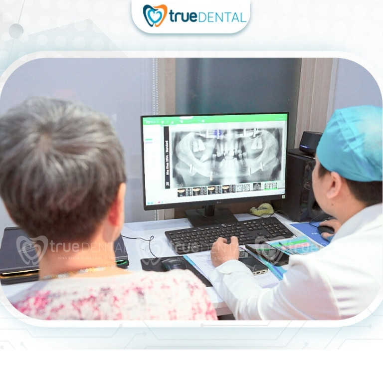 Ai cần làm implant niềng phối hợp tại Quận 3
