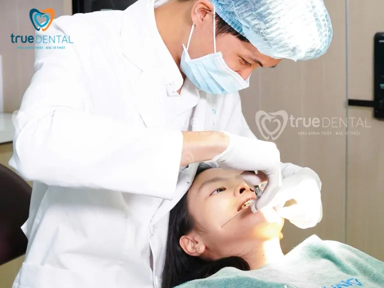 Câu hỏi thường gặp về gói niềng răng bao gồm những gì True Dental