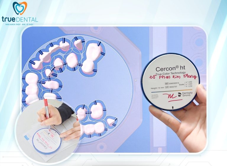 Chất Lượng Sứ Thẩm Mỹ True Dental So Với Nha Khoa Khác