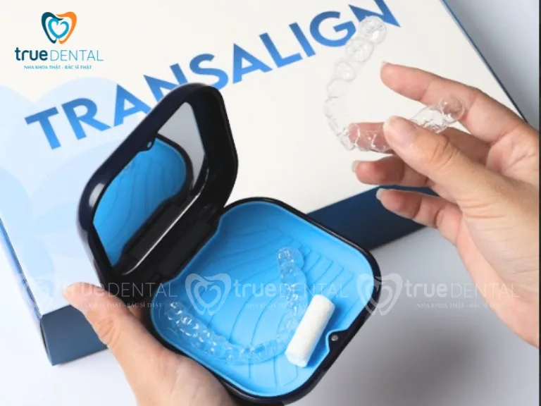 Cơ chế hoạt động của niềng răng Transalign