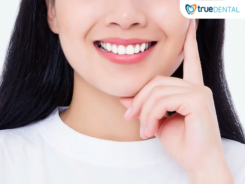 Combo niềng và sứ tại True Dental cho kết quả như thế nào